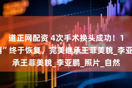 道正网配资 4次手术换头成功！19岁李嫣“兔唇”终于恢复，完美继承王菲美貌_李亚鹏_照片_自然